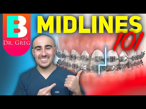 Видео: Брекеты Midlines 101 - Эластики, ИПР, спирали и многое другое!