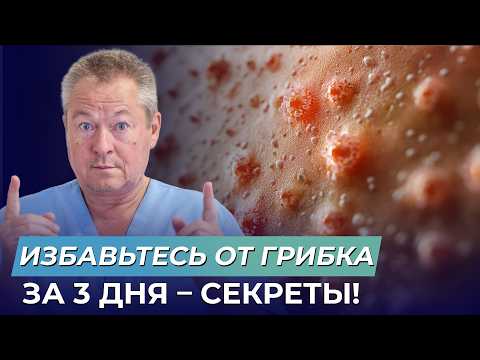 Видео: Как НАВСЕГДА избавиться от грибка в 2025 году?