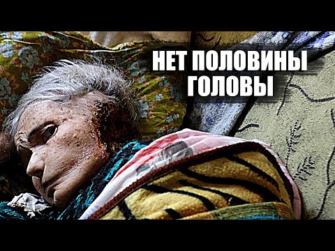 Видео: СЛАБОНЕРВНЫМ НЕ СМОТРЕТЬ! Такого не видел никто!