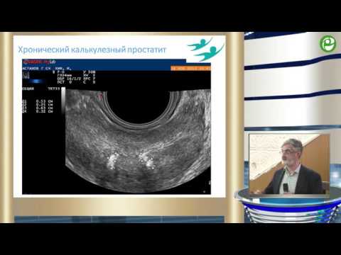 Видео: Габлия М Ю - Унификация протоколов ультразвуковых исследований предстательной железы