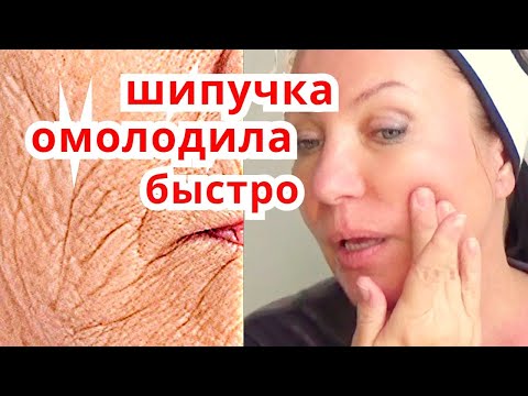 Видео: ШИПУЧКА для лица За копейки ! Быстрое Омоложение кожи! Маска От морщин