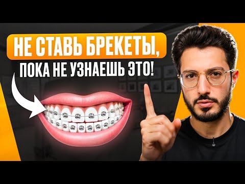 Видео: Не ставь БРЕКЕТЫ, пока не посмотришь это видео! Ортодонты молчат об этом!
