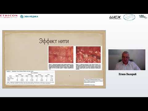 Видео: Анастомозы. Введение. Егиев В.