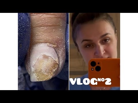 Видео: Купа відшарувань😱. Розпаковка гелів. Чохли з Аліка