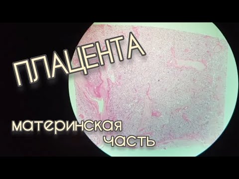 Видео: ПЛАЦЕНТА материнская часть (гистопрепарат)