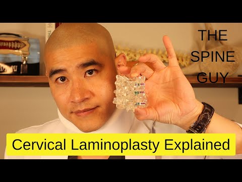 Видео: Объяснение цервикальной ламинопластики
