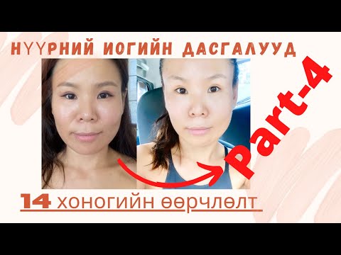 Видео: Нүдний үрчлээ, нүдний доод талын уутанцар, хөхрөлт, үрчлээ арилгах, зовхи өргөх дасгалууд (Part-4)