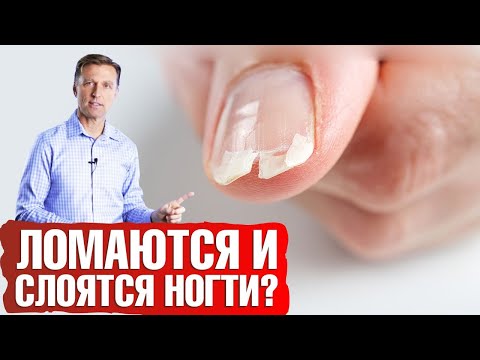 Видео: Ломаются и слоятся ногти? Как укрепить ногти🤔