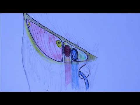 Видео: Бедренный канал, сосудистая и мышечная лакуны, подпаховое пространство  (Ахмадудинов А.М.)