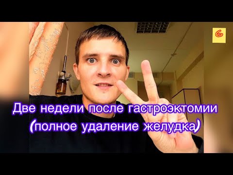 Видео: Вторая неделя после удаления желудка (гастроэктомия). Планы на будущее, питание