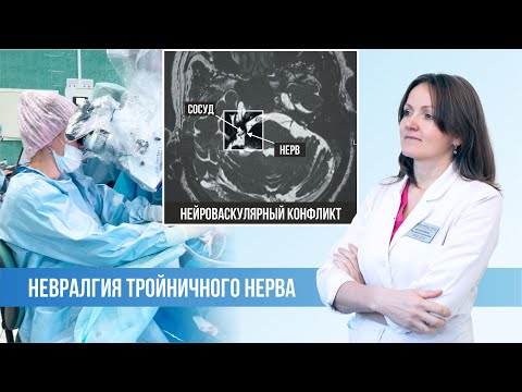 Видео: Невралгия тройничного нерва. Нейроваскулярный конфликт. Хирургическое лечение. Нездоровина В.Г.