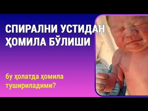 Видео: Спирални устидан ҳомила бўлиши: бу ҳолатда ҳомила тушириладими?