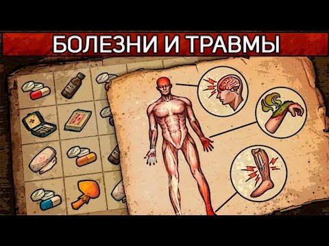 Видео: 🤕 Болезни и травмы гайд Day R survival 🤕 1# (Травмы)