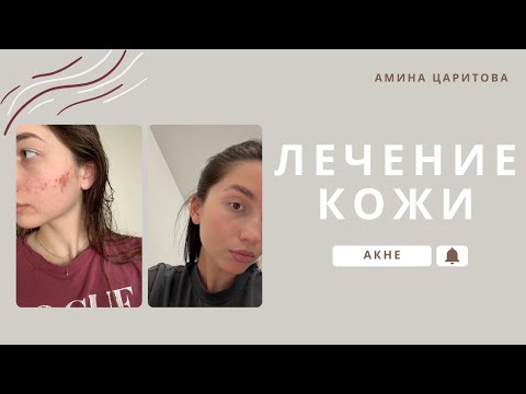 Видео: Как я вылечила кожу | Минеральная косметика