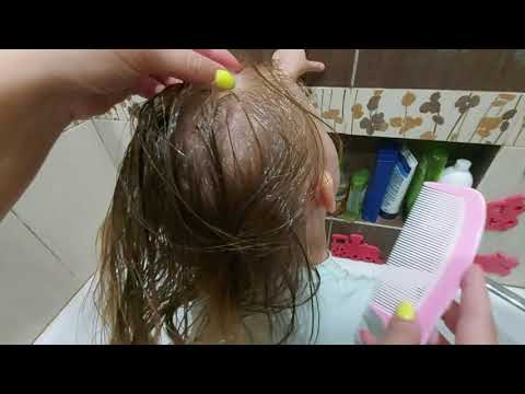 Видео: Корочки на голове у ребенка после 2 лет! Всего 1 средство. Реальное видео!