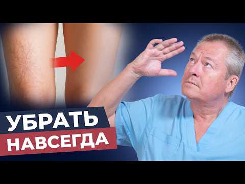 Видео: Сосудистые звездочки: простой способ убрать дома