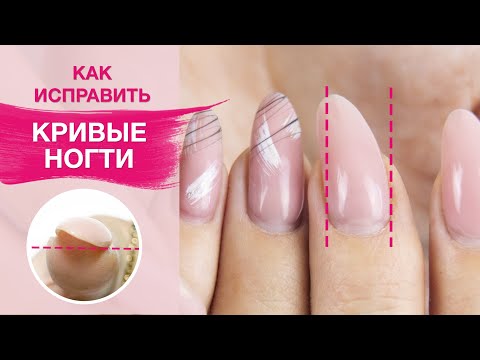 Видео: Как исправить кривой ноготь ? | Укрепление ногтей гелем