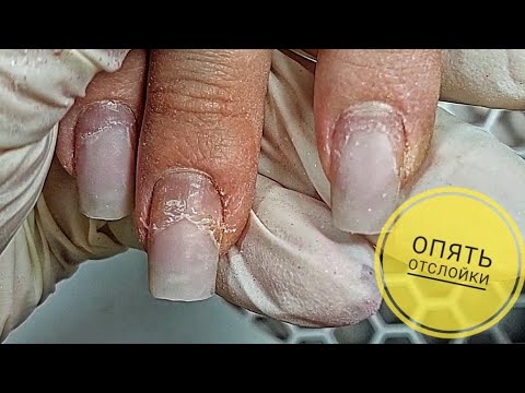 Видео: ОПЯТЬ ОТСЛОЙКИ 😢БОРЬБА ПРОДОЛЖАЕТСЯ 😕ОЧЕНЬ ЛЕГКИЙ ДИЗАЙН НОГТЕЙ
