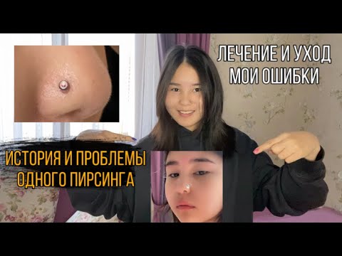Видео: Мне УЖАСНО ПРОКОЛОЛИ НОС. Мой пирсинг. Прокол и Воспаление