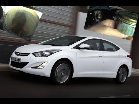 Видео: Белоснежка Elantra 1.8 устранение шумной работы двигателя