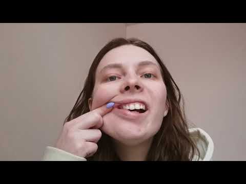 Видео: Паралич Белла гимнастика