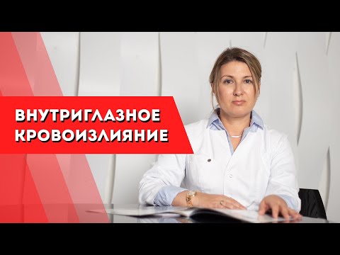 Видео: Внутриглазное кровоизлияние