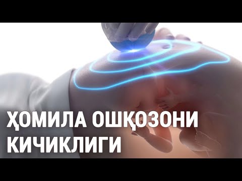 Видео: Ҳомила ошқозони кичиклиги