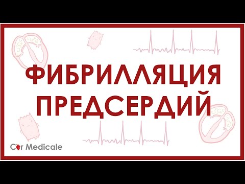 Видео: Фибрилляция предсердий
