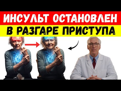 Видео: Пожилые люди, сделайте ЭТО, чтобы прервать инсульт, прежде чем он разрушит мозг | Советы для...