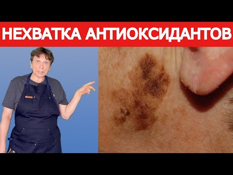 Видео: Вот что надо есть! Что бы избавиться от пятен. This is what you need to eat! To get rid of stains.
