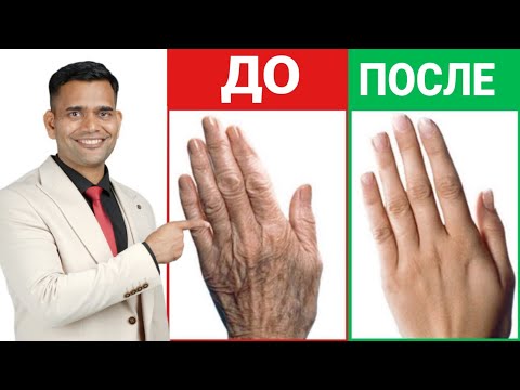 Видео: 1 СРЕДСТВО ОТ МОРЩИН НА РУКАХ И ПИГМЕНТНЫХ ПЯТЕН.