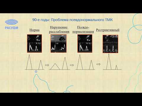 Видео: Эхокардиография в оценке диастолической функции