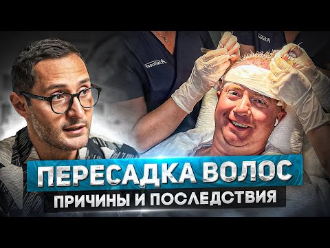 Видео: Все о пересадке волос у мужчин. Что делать, если появились залысины?