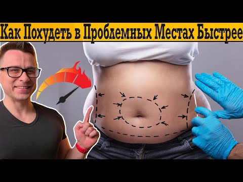 Видео: Диетолог отвечает - как быстро похудеть в проблемных местах!