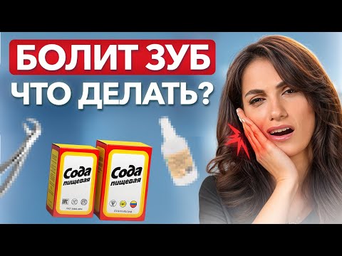 Видео: Срочно делай ЭТО, если заболел зуб! / Как БЫСТРО снять боль в зубах?