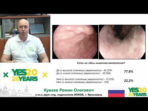 Видео: 54. Сложности эндоскопической диагностики кишечной метаплазии в желудке. Р. О. Куваев