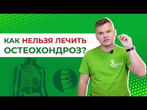 Видео: Как нельзя лечить шейный остеохондроз? Симптомы и причины шейного остеохондроза