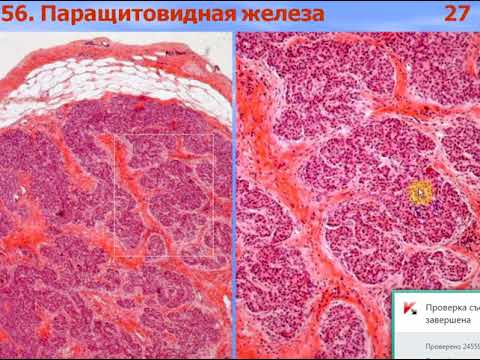 Видео: Дифференциальная диагностика экзаменационных препаратов по гистологии. Видео лекция С.М.Зиматкин