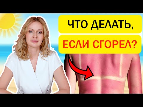 Видео: Что МОЖНО и НЕЛЬЗЯ делать при солнечном ожоге. Первая помощь в домашних условиях