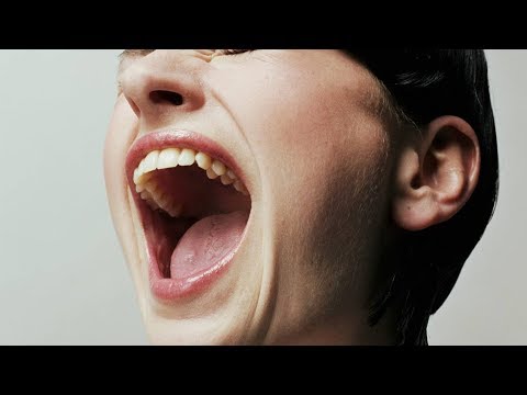 Видео: Как устранить вывих ВНЧС