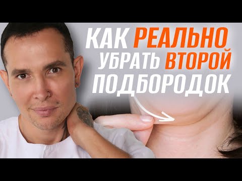 Видео: УБИРАЕМ ВТОРОЙ ПОДБОРОДОК | до и сразу после #мезонити  ДЛЯ ОВАЛА ЛИЦА