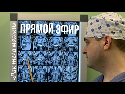 Видео: Рак тела матки. К.м.н. Оводенко Дмитрий Леонидович. Москва.