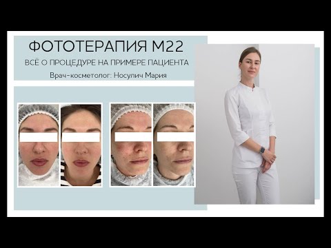 Видео: Фототерапия М22 - Всё о процедуре с примерами работ