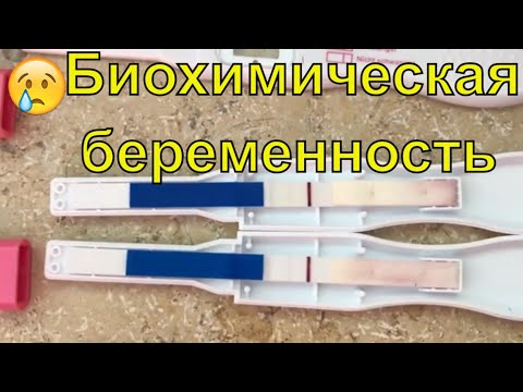 Видео: Биохимическая/замершая беременность