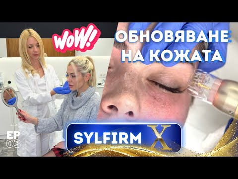Видео: Стягане и подмладяване БЕЗ ФИЛЪРИ, Sylfirm X с Калина Кузманова ЗДРАВА И КРАСИВА КОЖА