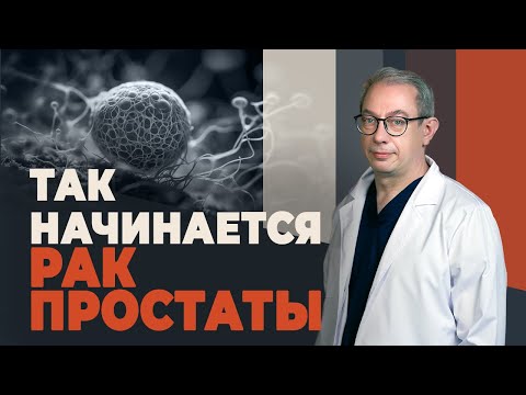 Видео: Признаки рака простаты, которые нельзя игнорировать