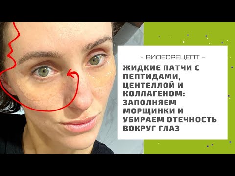 Видео: Жидкие патчи с пептидами, центеллой и коллагеном: заполняем морщинки и убираем отечность вокруг глаз