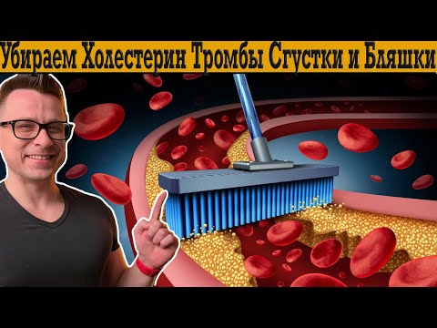 Видео: Убираем Холестерин, Бляшки, Сгустки и Тромбы! Здоровое сердце и сосуды!