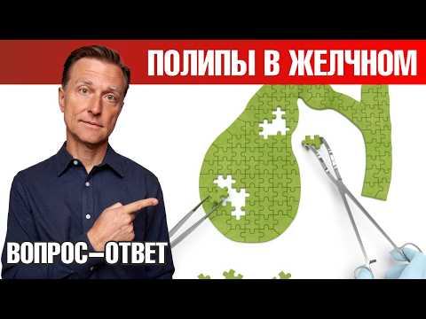 Видео: Как избавиться от полипов в желчном пузыре?🧐