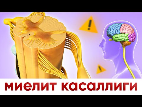 Видео: миелит  касаллиги | сабаблари | даволаш усуллари...